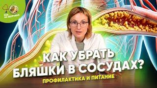 Бляшки на стенках сосудах – что делать? Атеросклероз. Профилактика и лечение ️