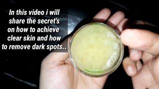 DIY Pimples and Dark Spots Removal|How to Achieve Clear Skin