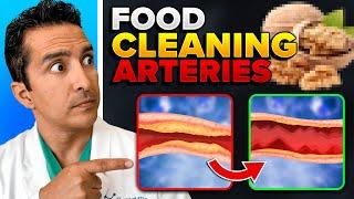 7 Foods That Cleans & Opens Up Arteries For People With Diabetes!