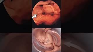 fetal movement #baby #movement #pregnant #women