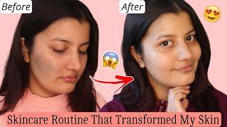 My Skin Transformation | Products & Supplements I Used