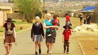 Albinism Awareness Month