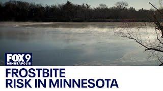 Minnesota health officials warn about frostbite