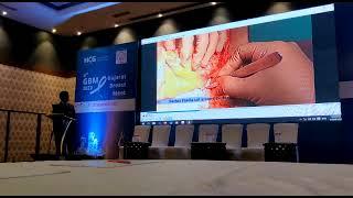 Dr. Amit Patil presenting DIEAP microvascular flap for whole Breast Reconstruction at 4th GBM-2022