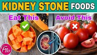  Kidney Stone Diet:- 17 Foods to Eat and 14 Foods to Avoid