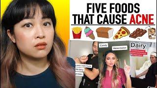 The Truth About Food, Diet and Acne | Lab Muffin Beauty Science