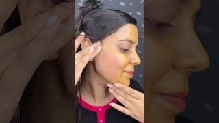 Remove *Facial Hair* at home | UNWANTED facial hair remove naturally #thesoni #skincare #skin #face