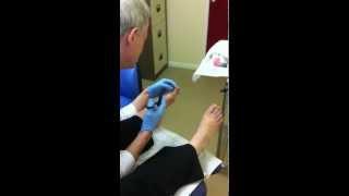 Chiropodist and Podiatrist in Norwich - Digital nerve block