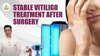 Stable Vitiligo Treatment After Surgery | Care Well Medical Centre