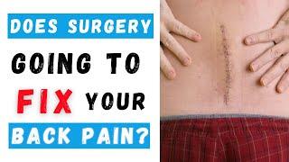 Will surgery alone fix your lower back pain?