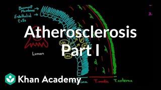 Atherosclerosis - part 1 | Circulatory system diseases | Health & Medicine | Khan Academy