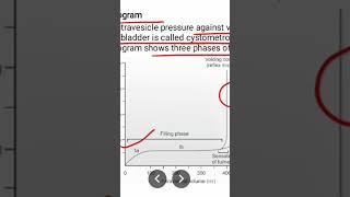 Cystometrogram