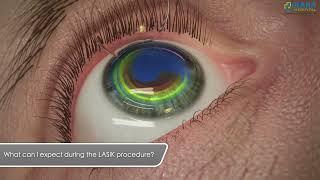 What Can I Expect During The Lasik Procedure | Rana Hospital