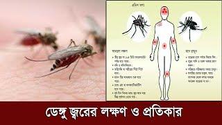 ডেঙ্গু জ্বরের লক্ষণ ও প্রতিকার | Dengue Symptoms & Prevention | Health News | Somoy TV