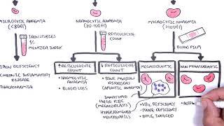 Anaemia (anemia) - classification (microcytic, normocytic and macrocytic) and pathophysiology