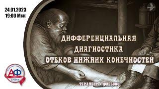 Дифференциальная диагностика отеков нижних конечностей (врачебная версия)