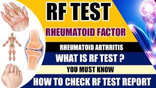 Rheumatoid Factor Test | What is RA factor test ?  Rheumatoid Arthritis