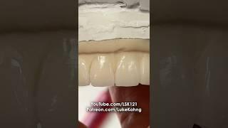 Signature Diagnostic Wax-Up #lsk121shorts #dental #teeth
