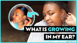 What's Growing On My Ear| STORYTRENDER