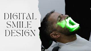 Transforming Smiles Digitally: Explore the Innovation of Digital Smile Design at Aksu Clinic!