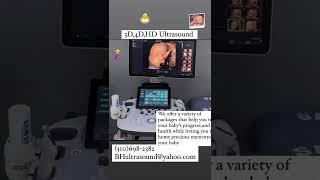 LA Ultrasound (Beverly Hills Ultrasound) - 3D, 4D, HD Ultrasound