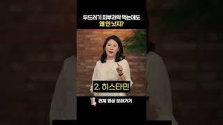 두드러기,피부과약 먹는데도 안 낫는 이유 있다!
