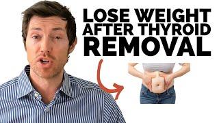 5 Tips for Weight Loss after Thyroidectomy: What your Doctor is Missing