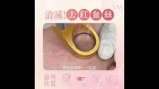 【微絲血管3】治療微絲血管 / 紅血管、青筋及色斑問題 / LUMI SKINCARE