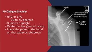 X-ray Positioning and Evaluation - AP Oblique Shoulder