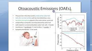 ENT OAE Otoacoustic Emissions Outer hair cells infant hearing test spontaneous evoked distorted