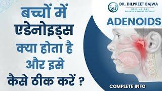 बच्चों में एडेनोइड्स क्या होता है और इसे कैसे ठीक करें ? #Adenoids Treatment, Complete Info Hindi