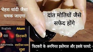 6 Uses of Alum /Fitkari and it's Benefits | त्वचा से जुड़ी मुश्किल से मुश्किल समस्या का 100% ईलाज