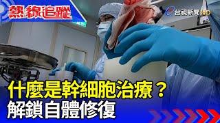 什麼是幹細胞治療？ 解鎖自體修復【熱線追蹤】