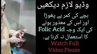Premature And Abnormal Fetus | Pregnancy Talk | Pregnancy Tips