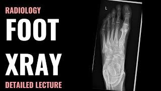 Foot Xray - Radiology - Detailed Lecture