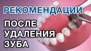 Что делать после удаления зуба? РЕКОМЕНДАЦИИ ПОСЛЕ УДАЛЕНИЯ ЗУБА