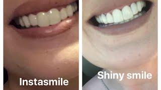 Shiny smile veneers vs instasmile veneers