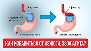 "Что Делать при Эзофагите и ГЭРБ? Правильное Лечение и Запреты"