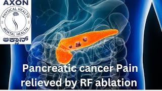 Abdominal cancer (Pancreatic cancer) pain relief with RF ablation procedure.