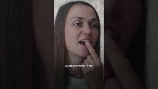 Что делать, если выпала пломба?