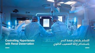 Controlling Hypertension with Renal Denervation