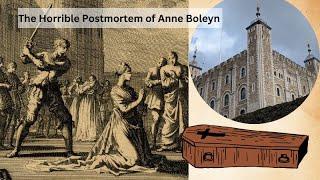 The Horrible Postmortem of Anne Boleyn