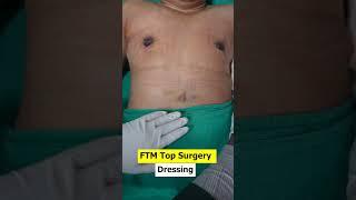 FTM  Top Surgery Dressing, RF Session