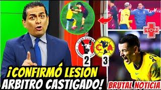 FMF CONFIRMA CASTIGO  AMÉRICA REMONTA 3-2 A PESAR DEL ROBO ARBITRAL | AMERICA vs TIJUANA