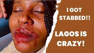 STORYTIME: GOT STABBED+POLICE DETENTION+LAGOS IS CRAZY!! DON’T LET ANYBODY KILL YOU O. #storytime