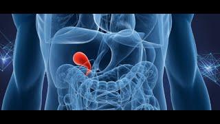 Gallstones on X ray: Porcelain Gallbladder