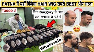 Hair Patch in Patna Bihar | Hair solution in two hours | HAIR PATCH FOR MEN and WOMEN in Patna