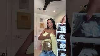 December 2025 🩵🩷 #pregnancy #glitter #shorts