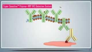 Immunohistochemistry (IHC) & Antigen/Epitope Protein Retrieval - Principle, Technique and Protocol