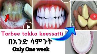 Ququllina IlkaaniitiifTeeth Whitening in just 3 minutes //